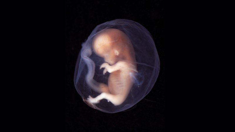 9 10 week human embryo 2048x1152